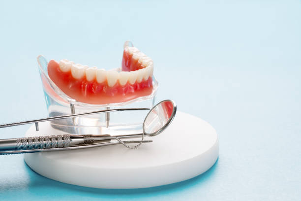 Dental Inlays and Onlays in Trenton, MO